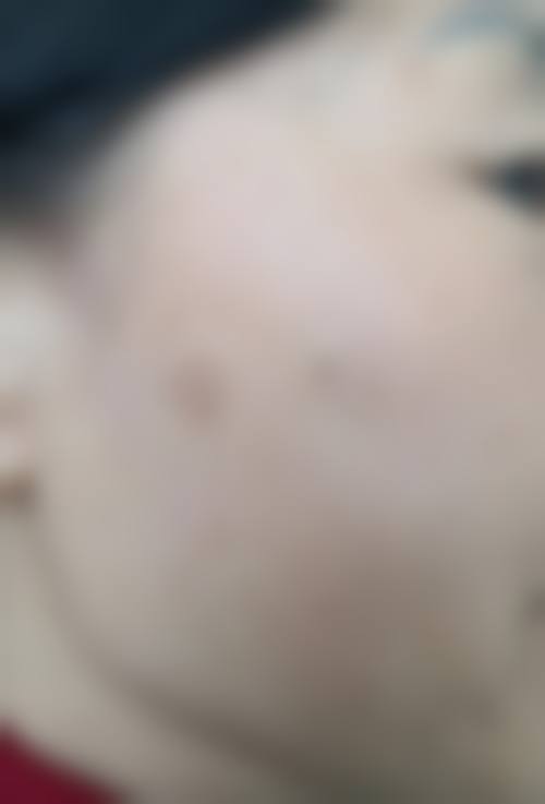【福州千慕医疗美容擅长项目有哪些？】
