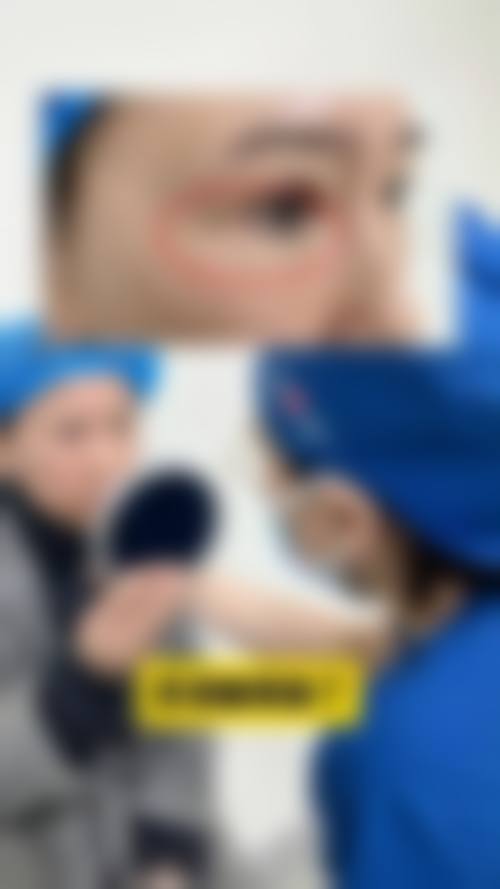 【合肥妍露整形医院真实患者评价】