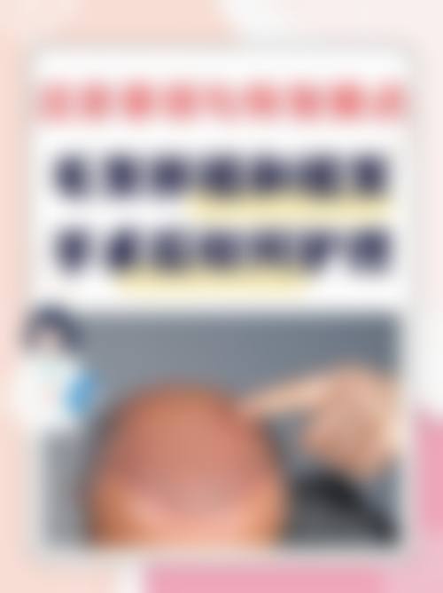 【潍坊科密植发擅长项目有哪些？】