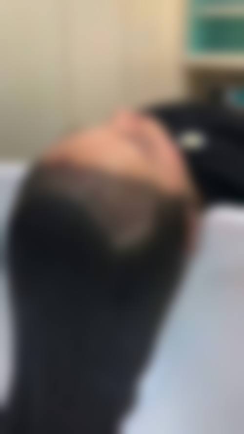 【潍坊科密植发医生团队】