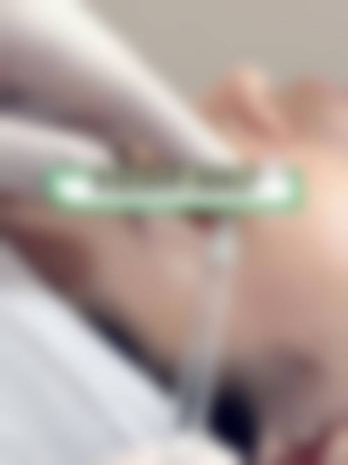 【钦州槎城华美医疗美容诊所真实患者评价】
