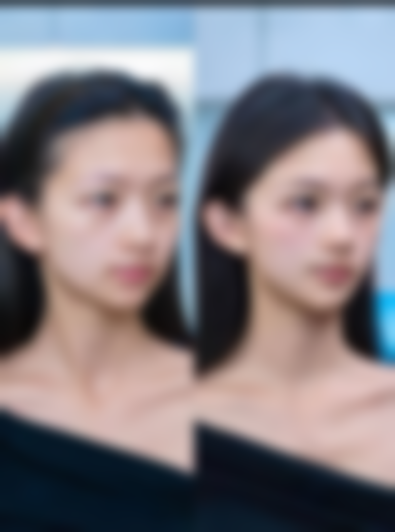 【北京溪峰聚美仕整形医院真实患者评价】