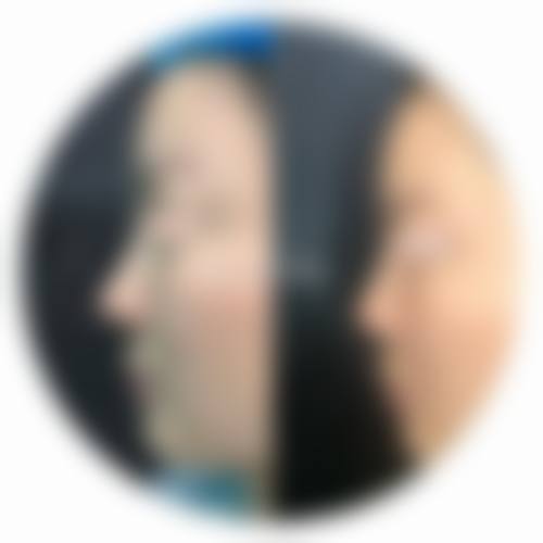 【洛阳张倩医疗美容诊所擅长项目有哪些?】