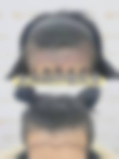 【荆州迪亚·罗兰激光医疗整形美容医院真实患者评价】
