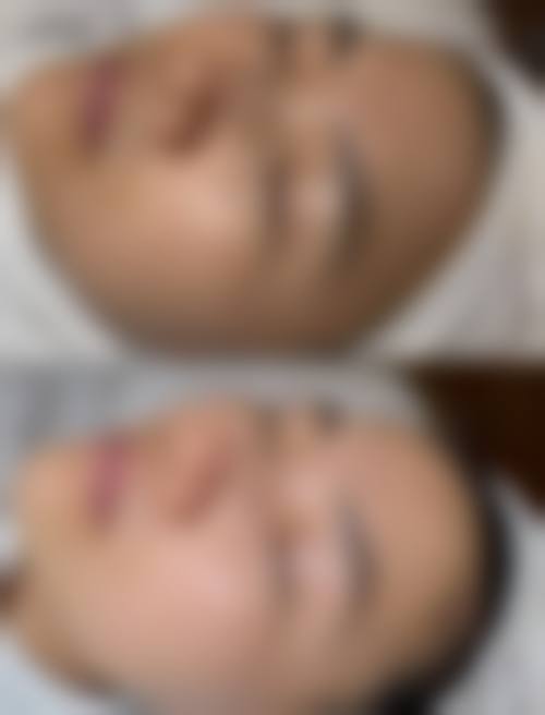 【合肥市蜀山区庞博医疗美容诊所擅长项目有哪些？】