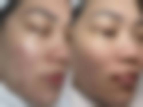 【濮阳时光医疗美容医院擅长项目有哪些?】