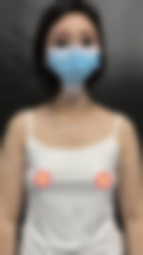【2026成都山之丘整形医院项目价格参考】