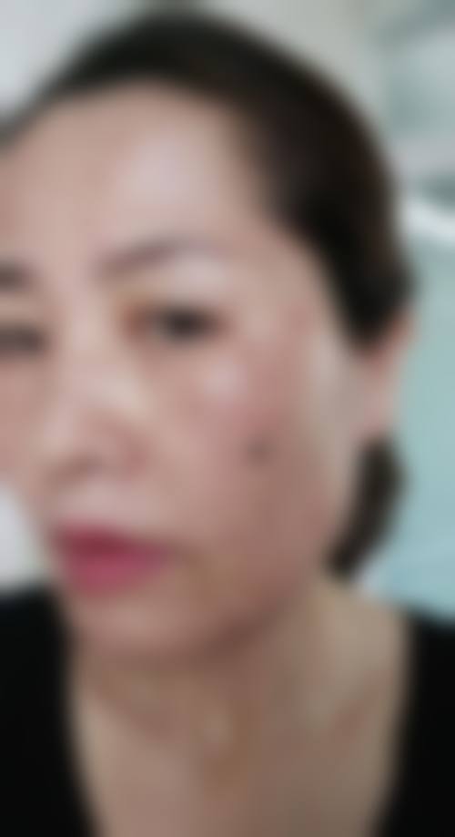 【2026濮阳时光医疗美容医院项目价格参考】