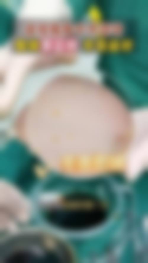 【成都山之丘整形医院擅长项目有哪些？】