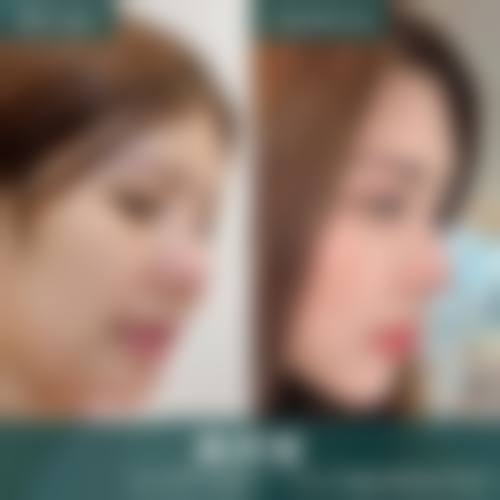 【河北石家庄中科悦妍整形医院交通路线及预约方式】