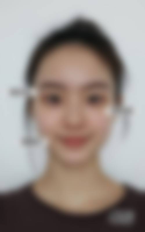 【大连曹建平医疗美容整形中 心真实患者评价】