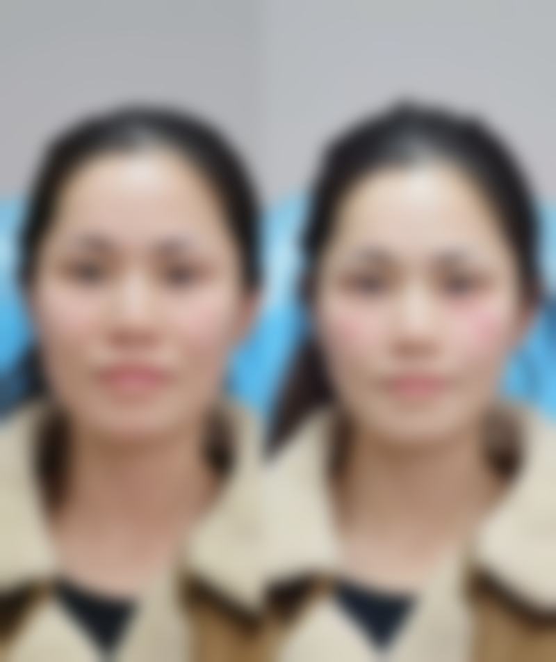 杨排芝擅长项目列表