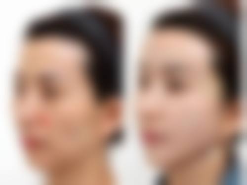 【2026牡丹江悦时空医疗美容诊所项目价格参考】