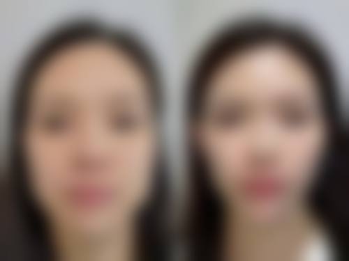 【牡丹江悦时空医疗美容诊所真实患者评价】