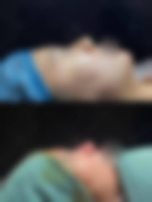 【南充钰妍医疗美容诊所真实患者评价】