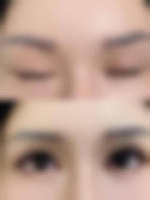 【南平爱惟夷医疗整形门诊部真实患者评价】