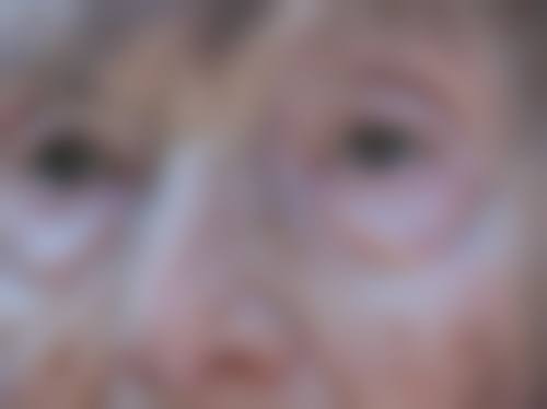 【浙江嘉兴永康俞福进整形医疗美容诊所真实患者评价】