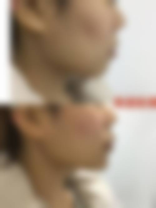 【首尔slim外科医院真实患者评价】