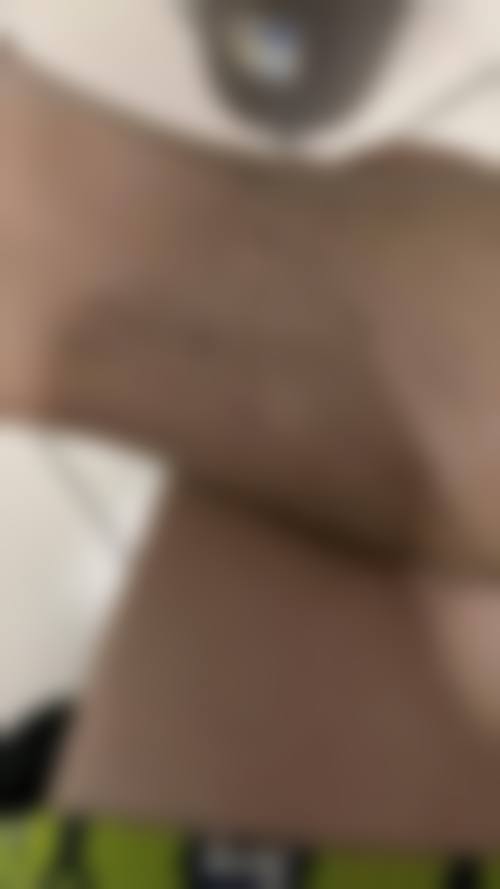 【武汉仁爱整形美容医院擅长项目有哪些？】