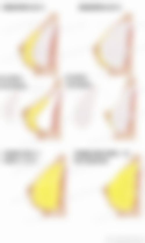【重庆玺雅医疗美容诊所真实患者评价】