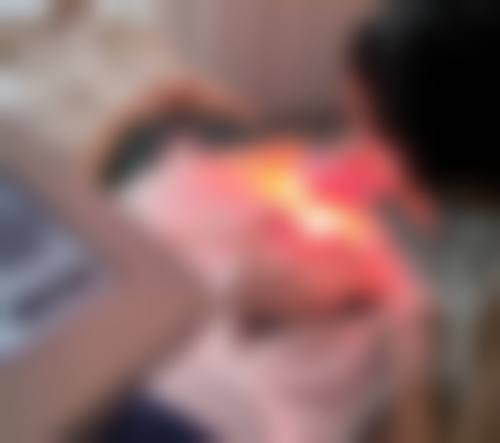 【东莞莞城曾学林整形医院擅长项目有哪些？】