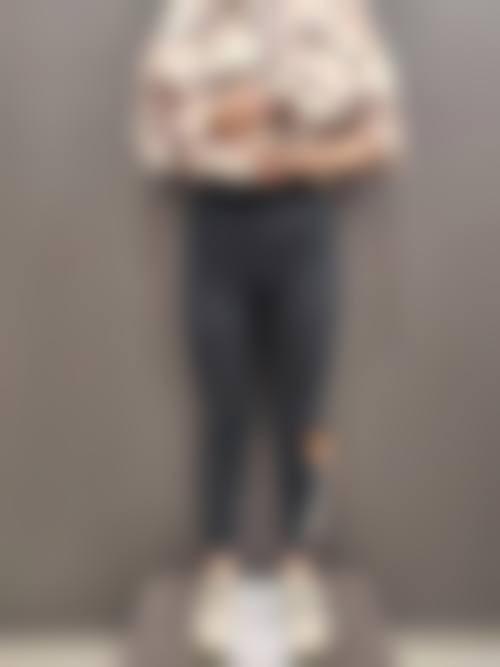 【深圳妍幂整形医院真实患者评价】