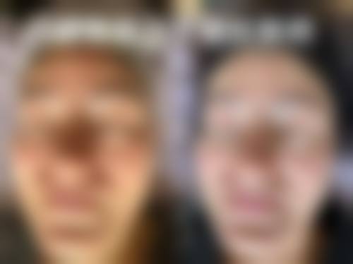 【东莞莞城曾学林整形医院交通路线及预约方式】