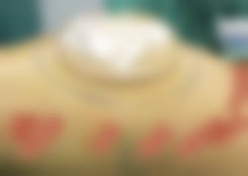 【宝鸡丽人妇科医院医学整形科真实患者评价】