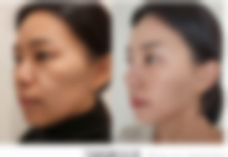 【郑东懿美整形美容医院真实患者评价】