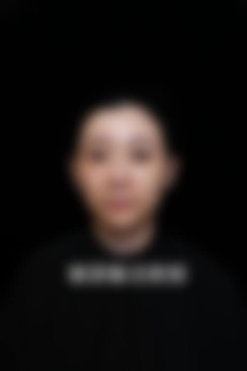 【康定艾思汐整形医院擅长项目有哪些?】