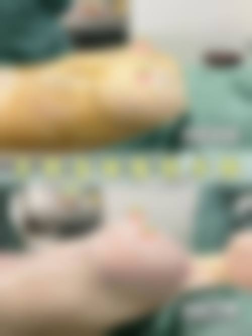 【广州优游医疗美容诊所真实患者评价】