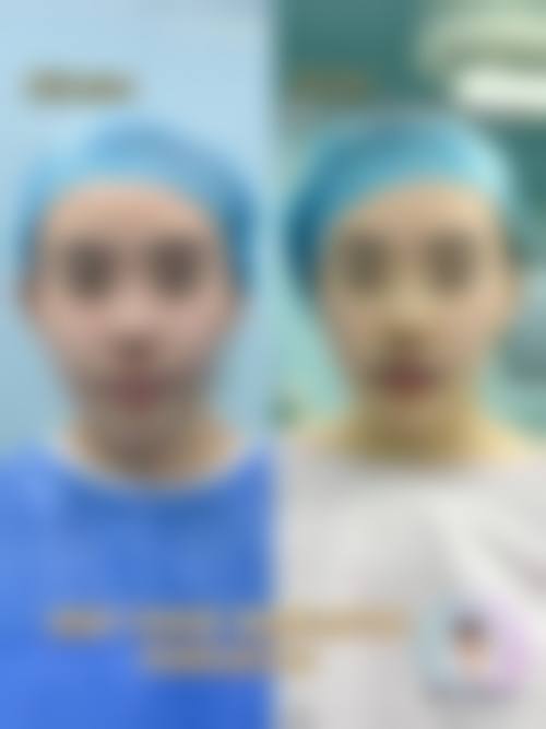 【肇庆宝柏时光整形医院擅长项目有哪些？】