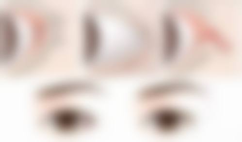【成都僮颜美容整形医院真实患者评价】
