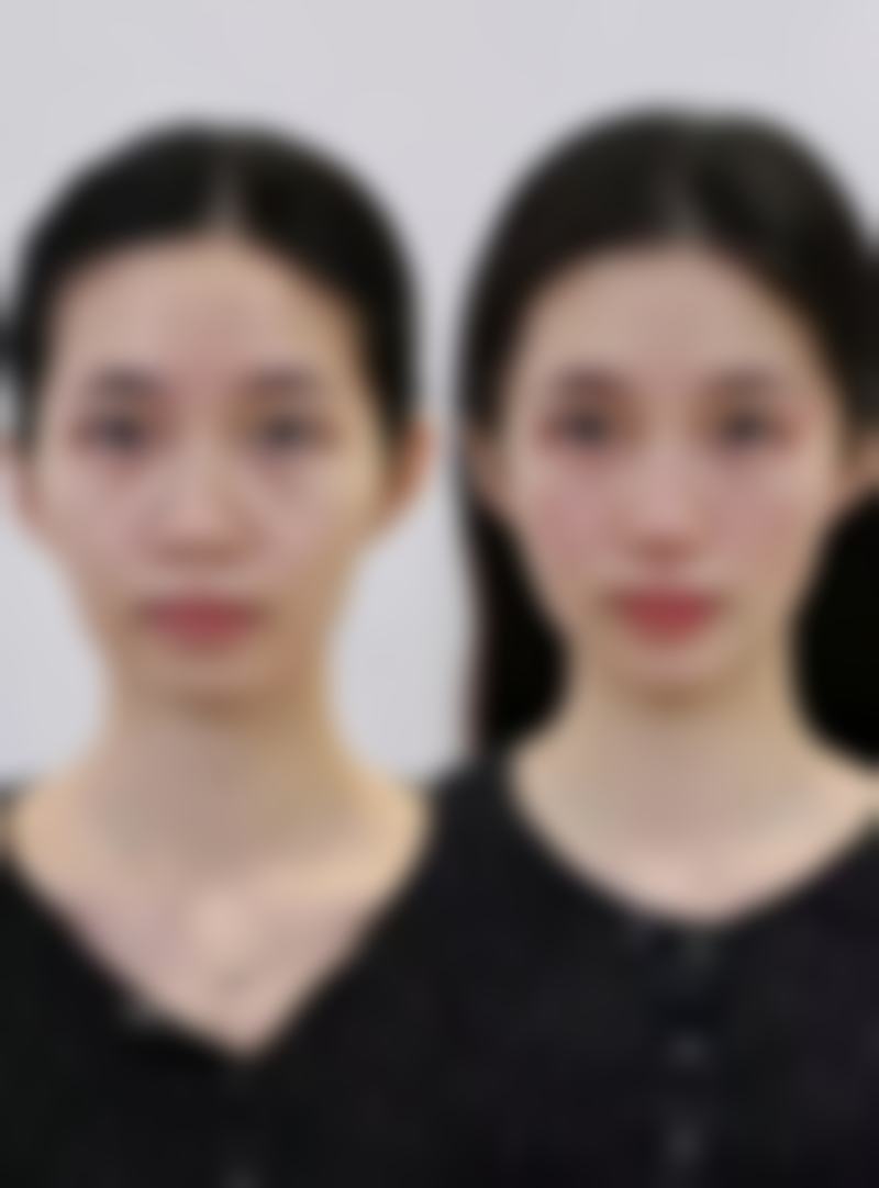 【2026 康定艾思汐整形医院项目价格参考】