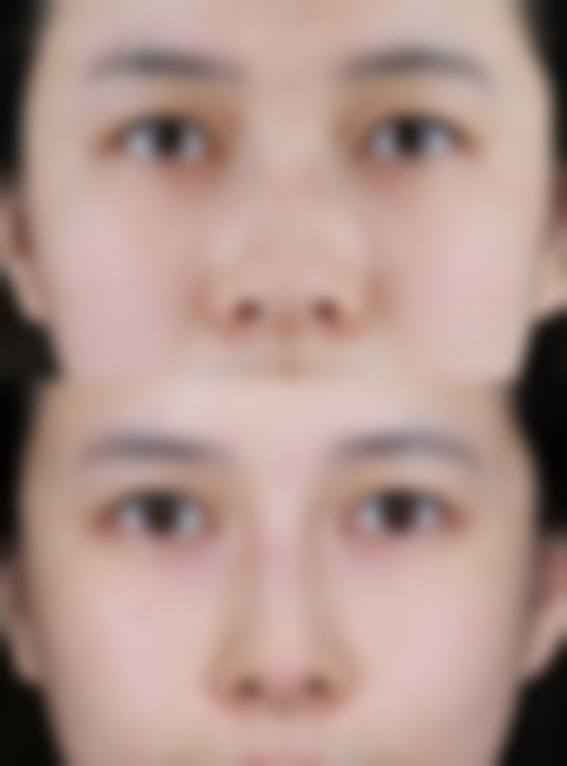 【广州优游医疗美容诊所专精设备与服务保护】