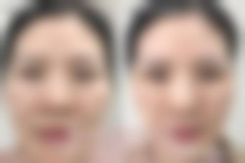【北京台娢医疗美容诊所真实患者评价】