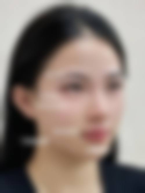【2026 郑州明眸艺术整形医院项目价格参考】