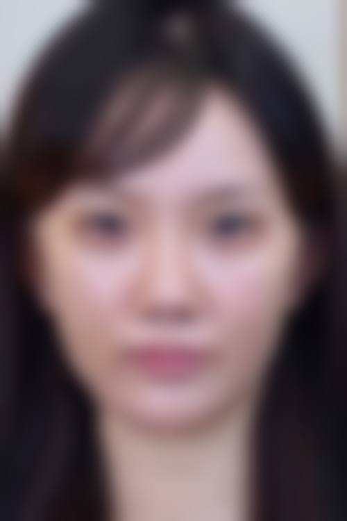 【重庆芙芮熙雅整形医院真实患者评价】