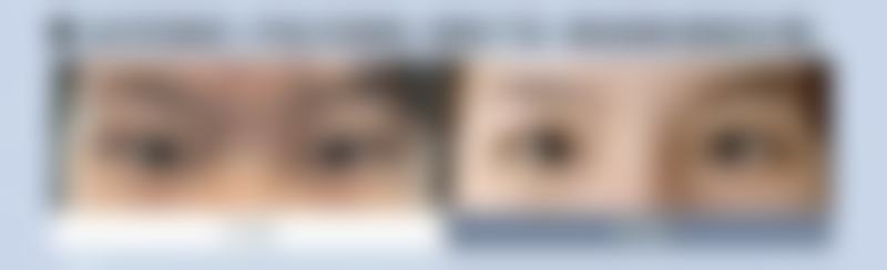 【郑州明眸艺术整形医院医生团队】