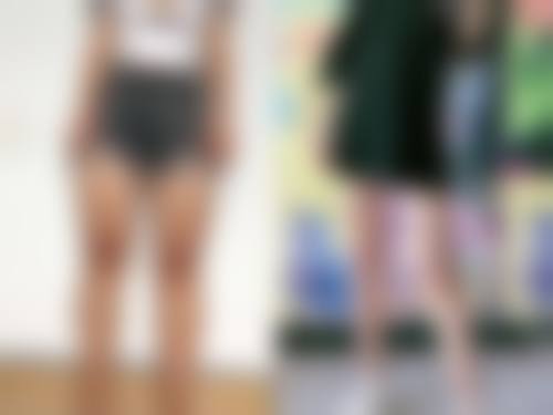 【成都高新漾肤医疗美容诊所真实患者评价】