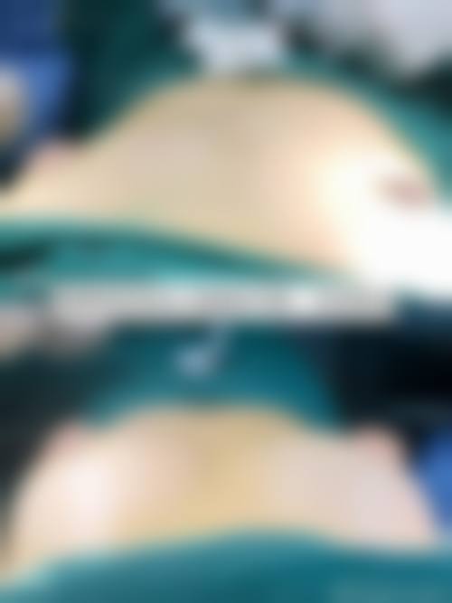 【深圳永和医疗美容门诊部真实患者评价】