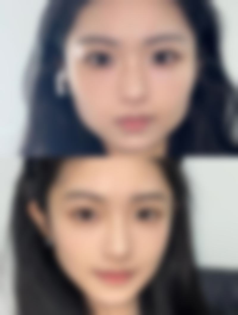 【2026 荆州市华美医疗整形美容项目价格参考】
