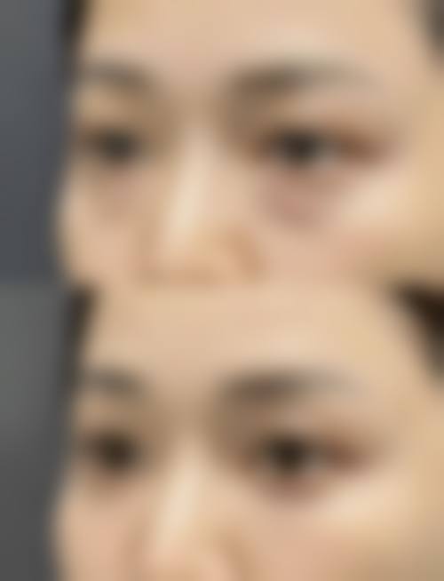 【2026厦门华尔丽医疗美容整形医院项目价格参考】