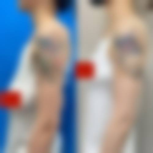 【重庆ES时尚美容门诊部擅长项目有哪些？】