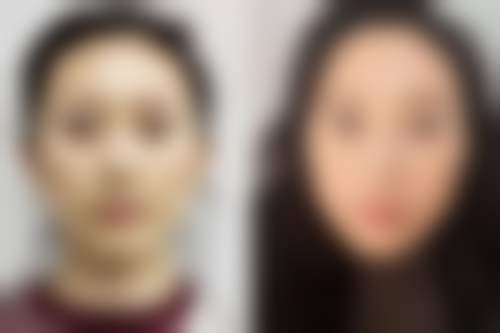 【杭州云系医疗美容医院真实患者评价】