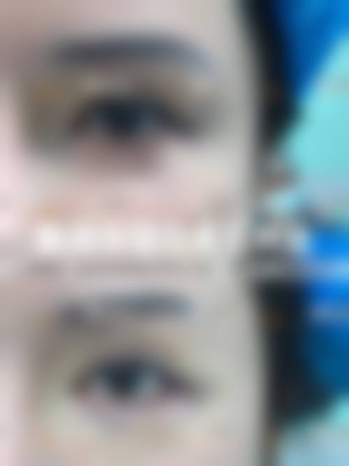 【陕西汉中璞奢佰斯汀整形医院擅长项目有哪些？】