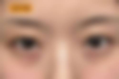 【成都太古世家医疗美容诊所真实患者评价】