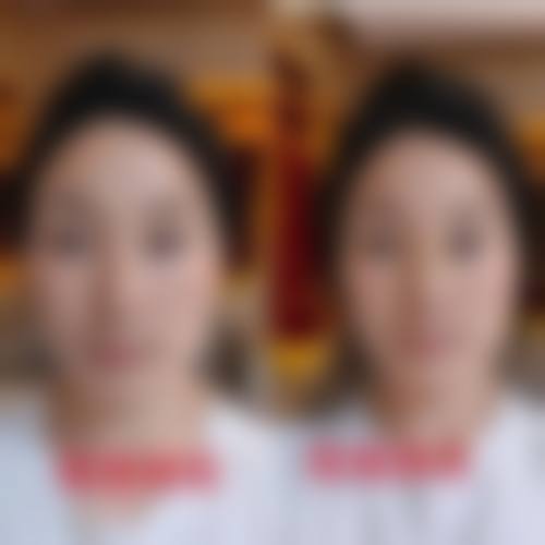 【2026 宁德华美医疗美容门诊部项目价格参考】