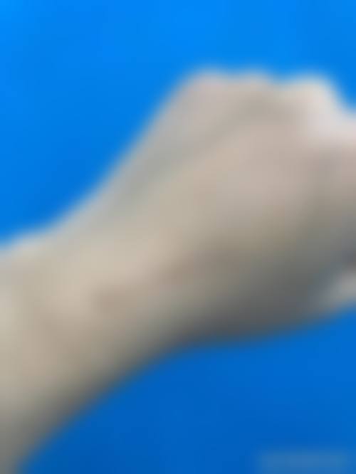 【成都太古世家医疗美容诊所擅长项目有哪些？】