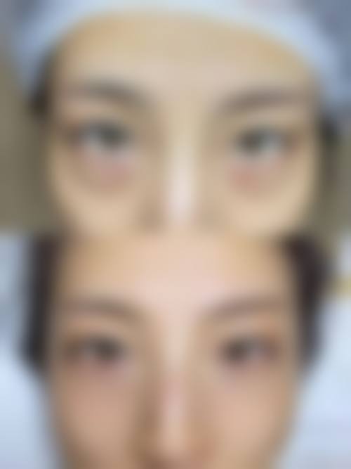 【重庆斐暮星雅医疗美容真实患者评价】